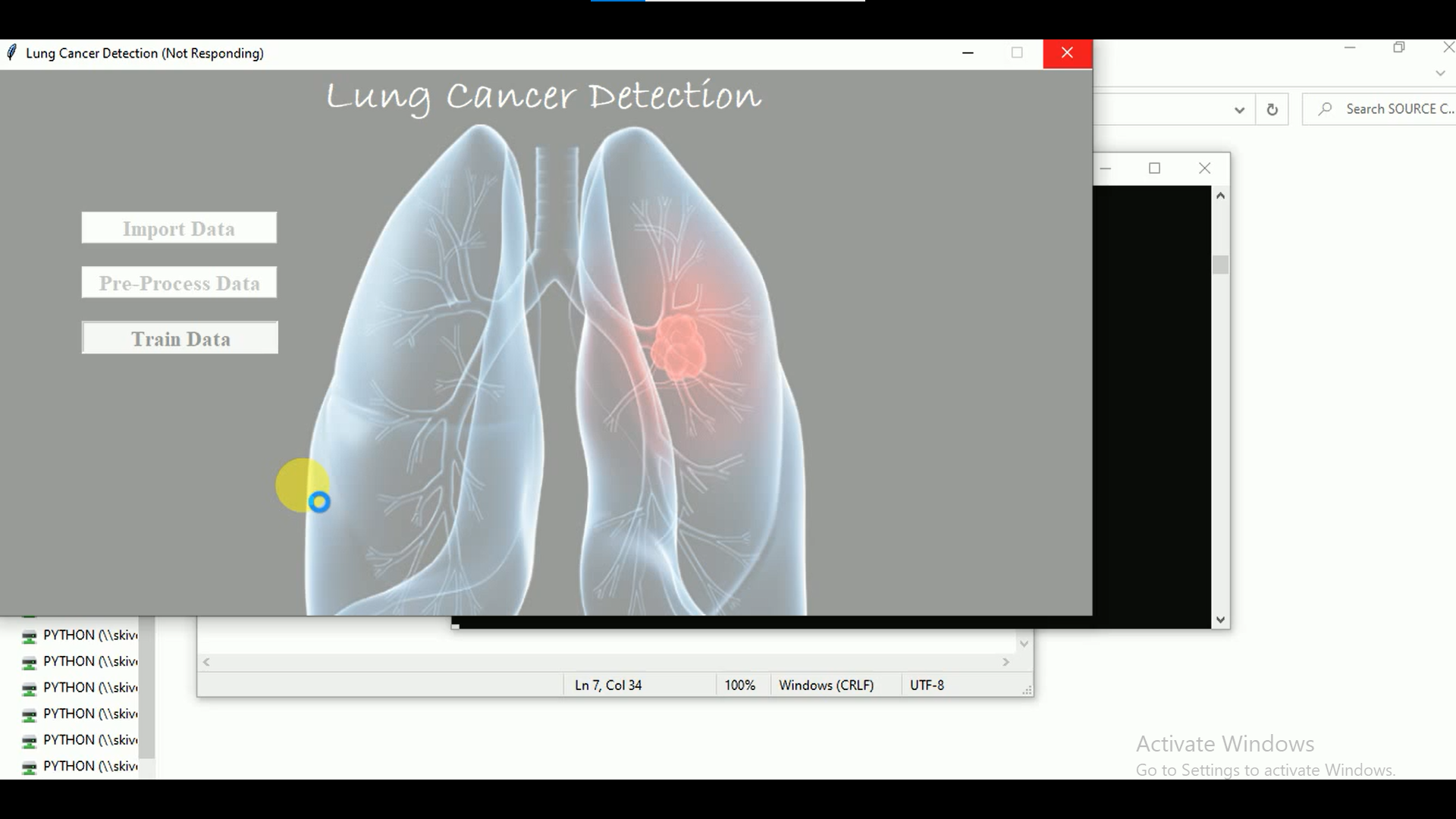 Lung Disease Prediction Using Deep Learning Techniques In Streamlit Framework